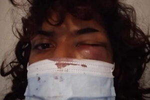 Trans 21enne pestata a sangue senza motivo a Catania